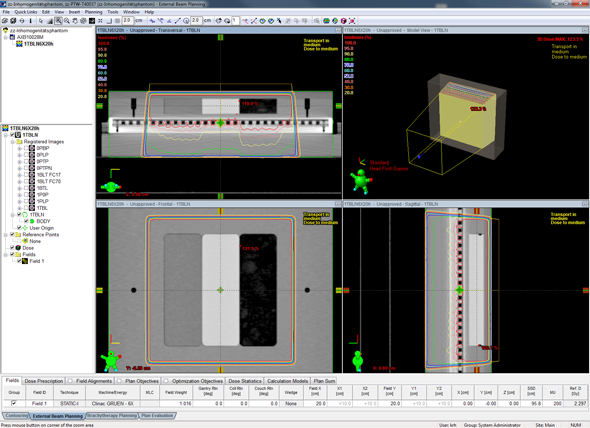 Calculation with AXB, dose to medium