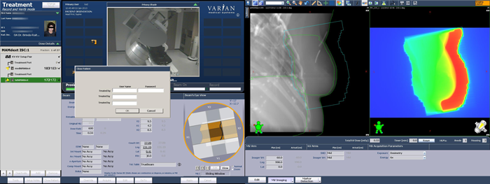 TrueBeam screenshot after 1st patient treatment