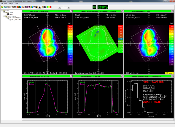 EPIQA evaluation of a 10FFF plan