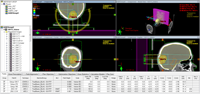 Correct AXB field dose