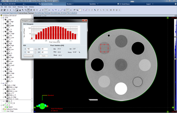 Measuring HU for the material inserts. ROI size: 40 x40 px.