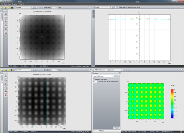 Comparing dose calculations with 1 mm and 2.5 mm grid size