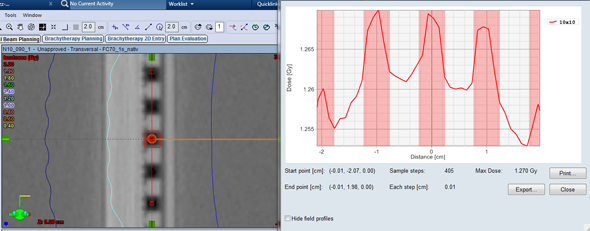 Cross profile AAA calculation, 1mm grid