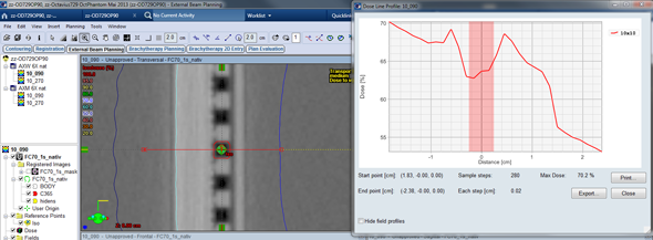 Depth dose profile 90° AXW calculation