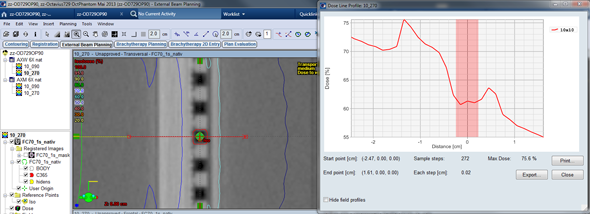 Depth dose profile 270° AXW calculation