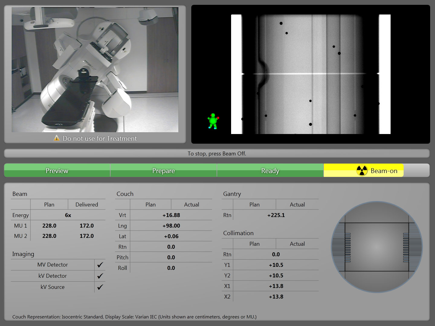 Measuring MLC Backlash with MPC 2.7