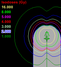 Brachy-Isodosenplan